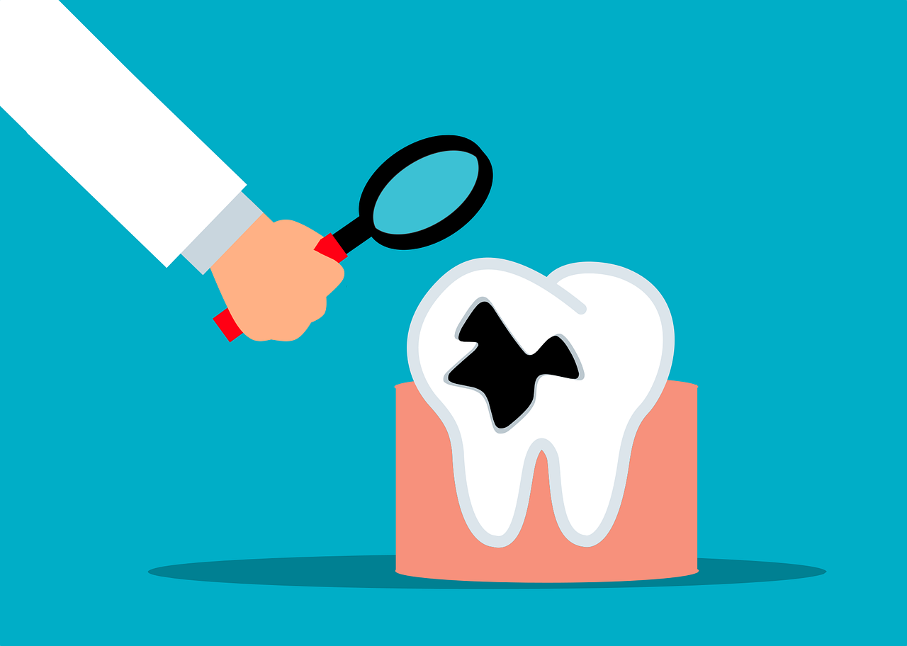 tooth decay, dentist, dental, bad, decay, tooth, medical, white, cartoon, care, health, check, mouth, pain, healthy, disease, ache, illness, cavity, sick, clean, oral, problem, treatment, bacteria, tooth decay, tooth decay, tooth decay, tooth decay, tooth decay, dentist, tooth, cavity, cavity